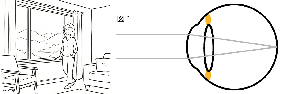 毛様体筋はゆるみ、水晶体は薄くなっている